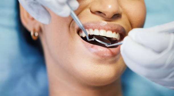Best Emergency Gum Treatment in St Paul, MO