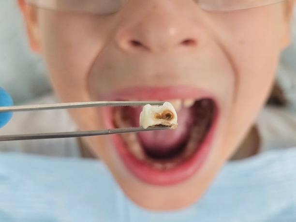 Best Emergency Orthodontic Services in St Paul, MO